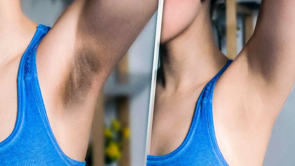 Длинные волосы в подмышках