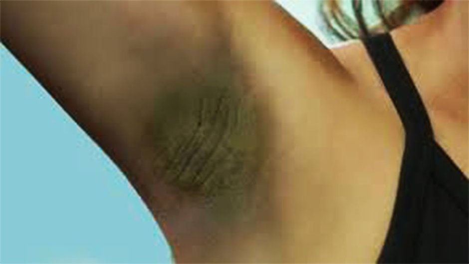 Подмышки розовый фон